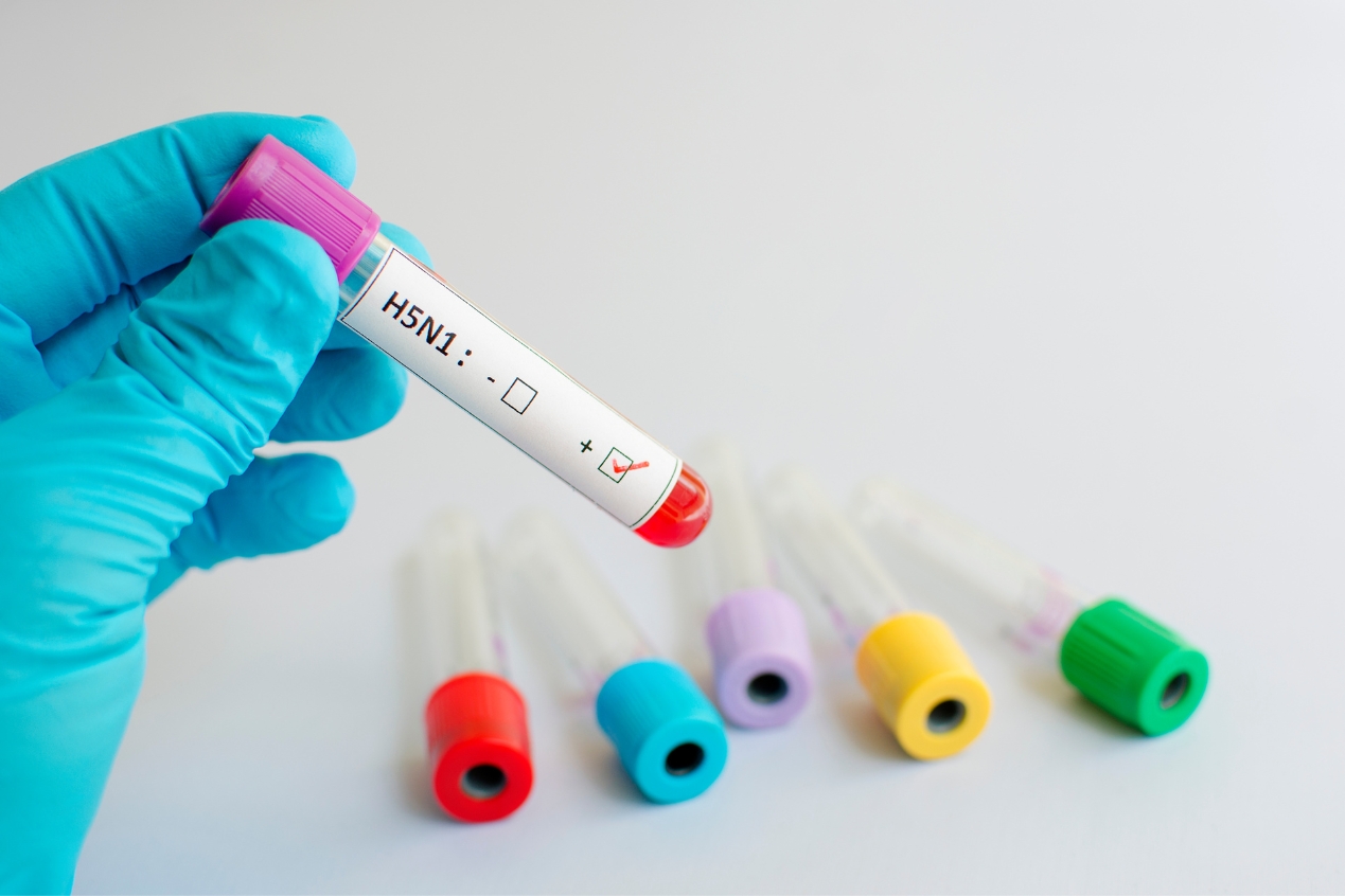 Primer caso grave de influenza aviar H5N1 confirmado en Estados Unidos