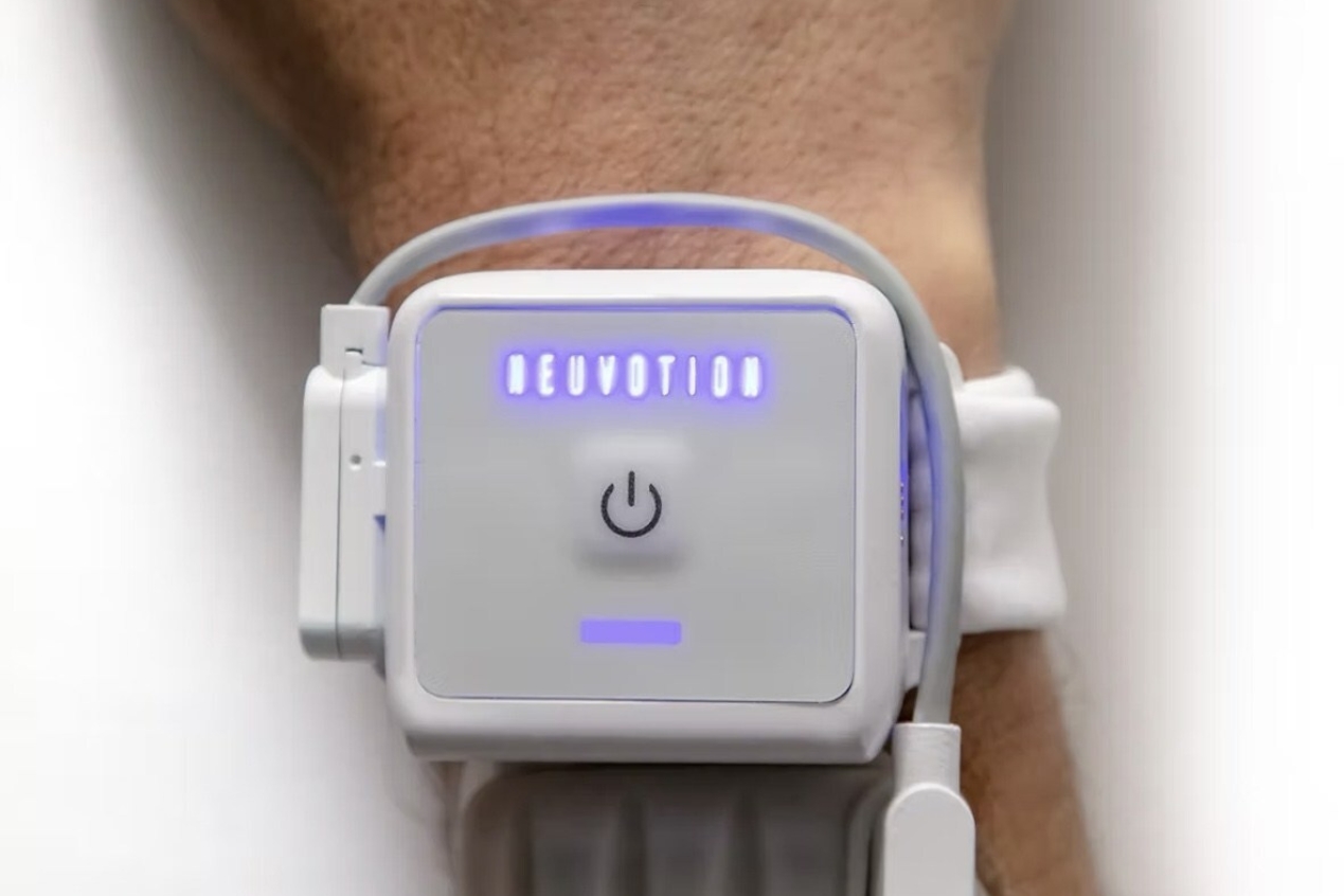 Tecnología neuromoduladora mejora la rehabilitación de ACV y lesiones medulares