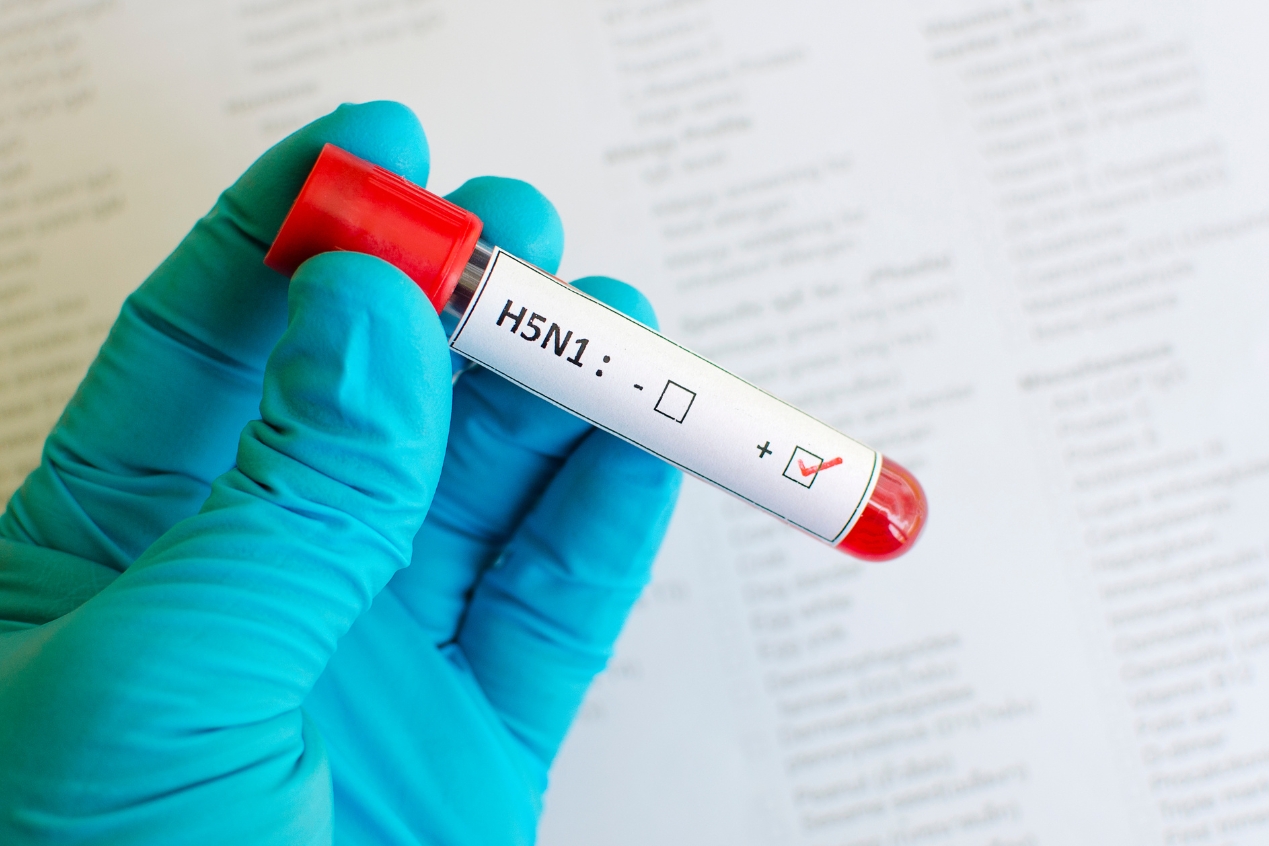 Primera muerte por influenza aviar H5N1 confirmada en EE. UU.