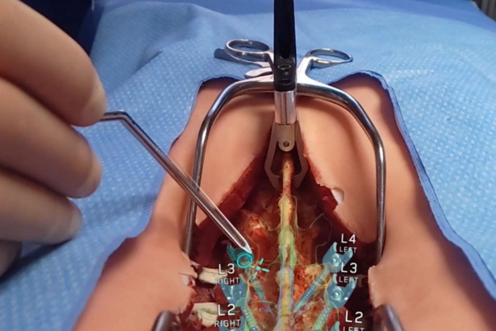 Medivis recibe autorización de la FDA para su plataforma Spine Navigation, que integra inteligencia artificial y realidad aumentada en cirugías de columna.