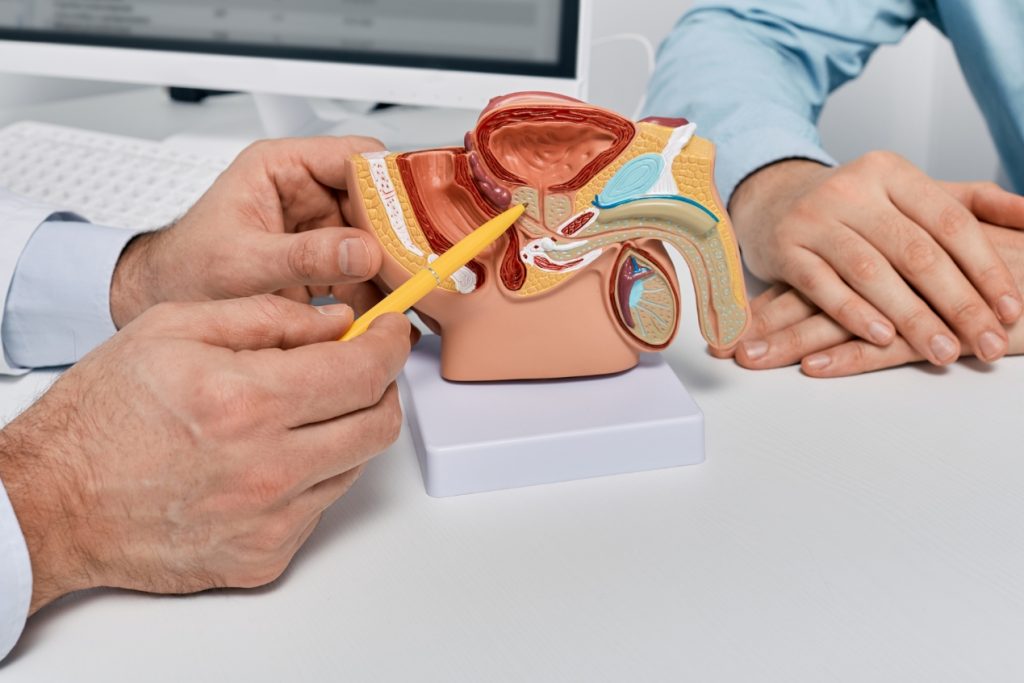 Ensayo clínico evaluará nuevo fármaco oral para cáncer de próstata resistente a la castración