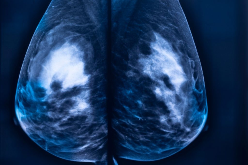 Florida incorpora primer sistema de tomografía mamaria Koning Vera en centro integral de imágenes